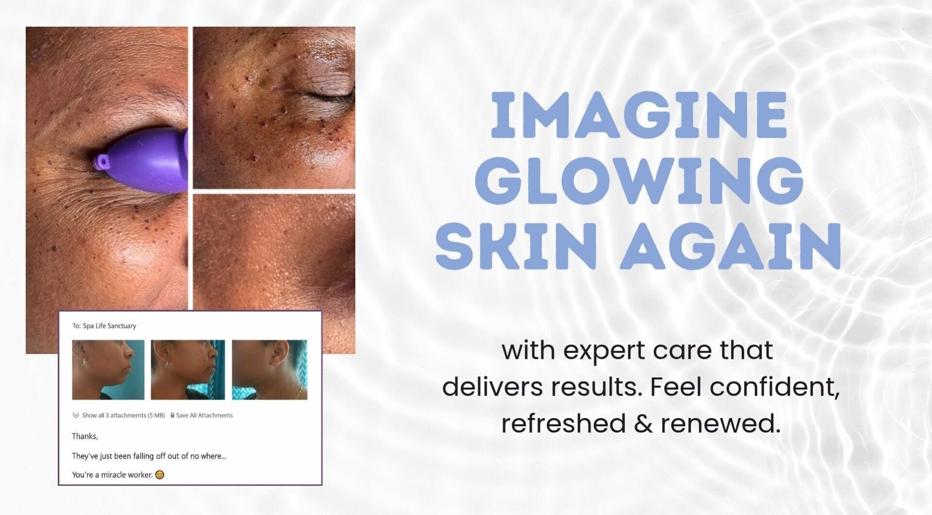 Rejuvenated skin treatment results at Spa Life Sanctuary in Philadelphia, Pennsylvania, US.