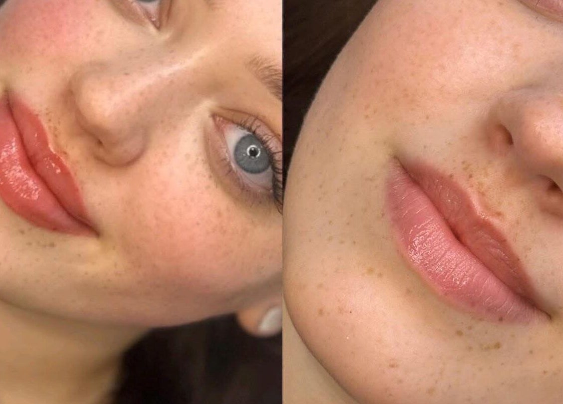 Close-up of lip enhancement by By Marcella (Clitheroe), showcasing glossy pink lips, Clitheroe, England, GB.