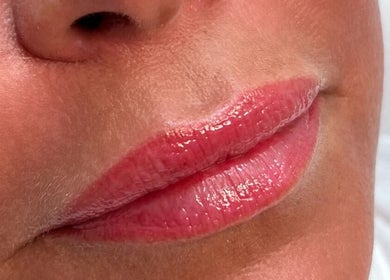 Glossy enhanced lips at Jenny Jones Ink & Aesthetics, East Grinstead, England, GB.