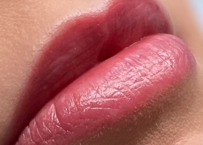 Close-up of enhanced lips by Jenny Jones Ink & Aesthetics, East Grinstead, England, GB.