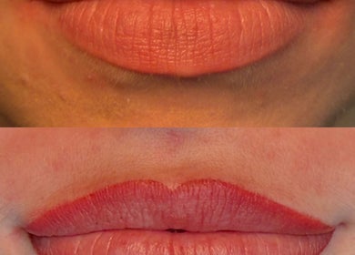 Before and after lip pigmentation at Keep It Cassie, Hucclecote, England, GB showcasing color enhancement.