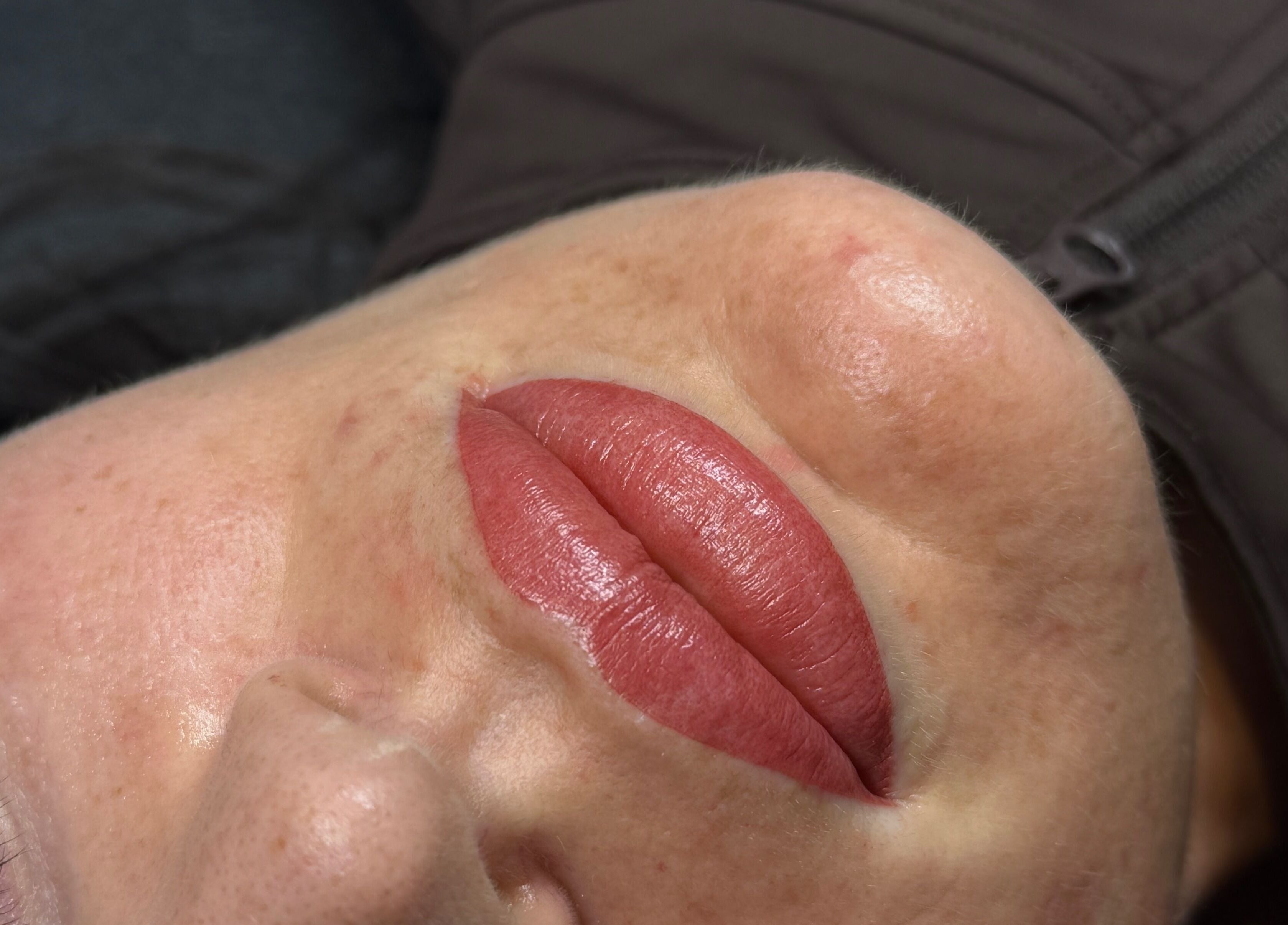 Close-up of enhanced lips after treatment at Keep It Cassie, Hucclecote, England, GB.