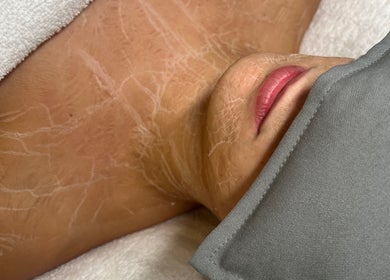 Facial treatment in progress at BARE SSKIN, Melbourne, Victoria, AU, showcasing luxurious skincare therapy.