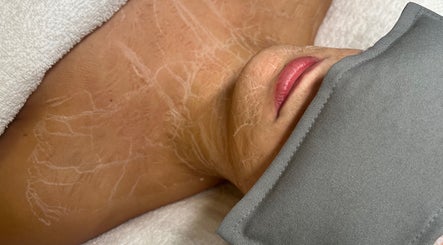 Facial treatment in progress at BARE SSKIN, Melbourne, Victoria, AU, showcasing luxurious skincare therapy.
