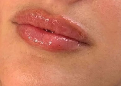 Close-up of glossy lips treated at Fillersldn Gravesend, Gravesend, England, GB for a vibrant look.