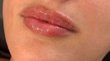Close-up of glossy lips treated at Fillersldn Gravesend, Gravesend, England, GB for a vibrant look.