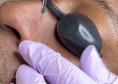 Detail of a facial treatment at The GLÓ Studio in Lee-on-the-solent, England, GB enhancing skincare experience.