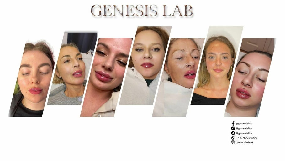 Genesis Lab Wallsend Aesthetics image 1