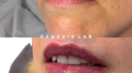 GENESIS LAB image 2