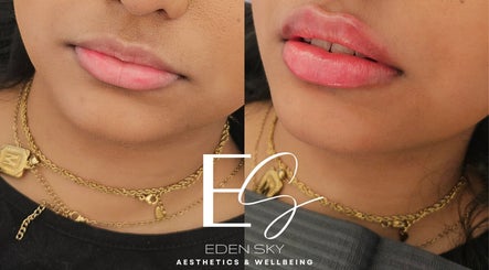 Eden Sky | Aesthetics & Wellbeing