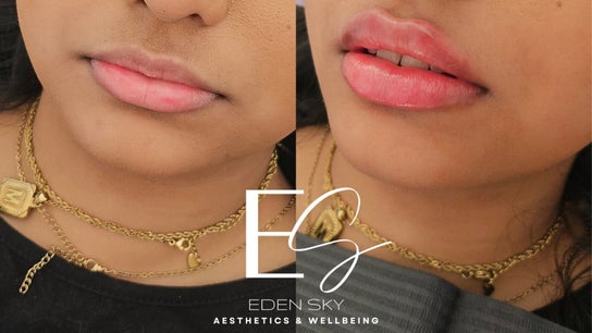 Eden Sky | Aesthetics & Wellbeing