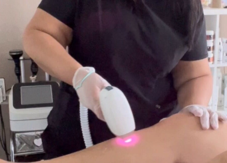 Tratamiento de depilación láser en Glow Esthetic By Paola en Canovanas, Puerto Rico, US.