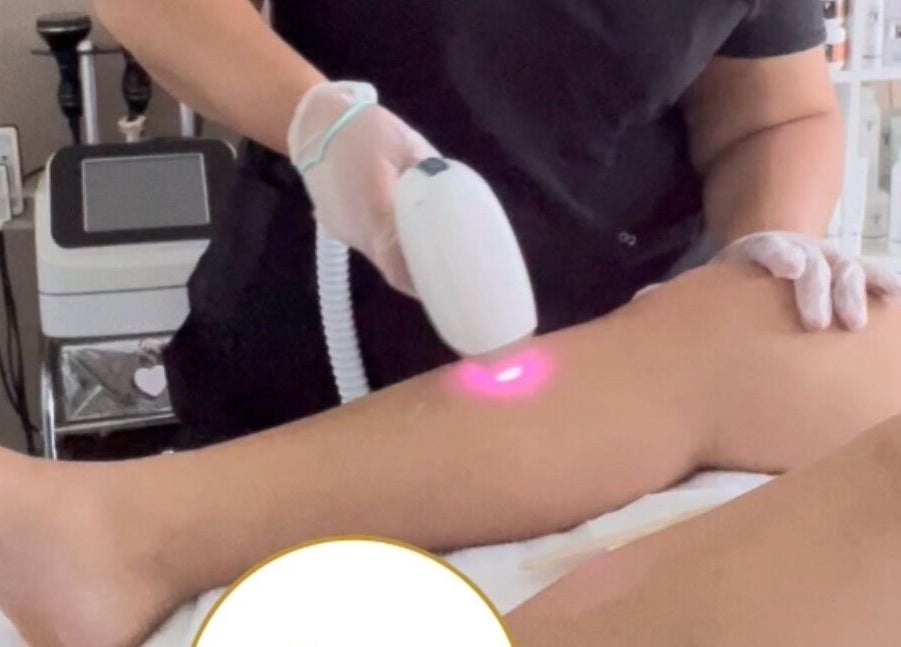 Tratamiento de depilación láser en Glow Esthetic By Paola, Canovanas, Puerto Rico, US.