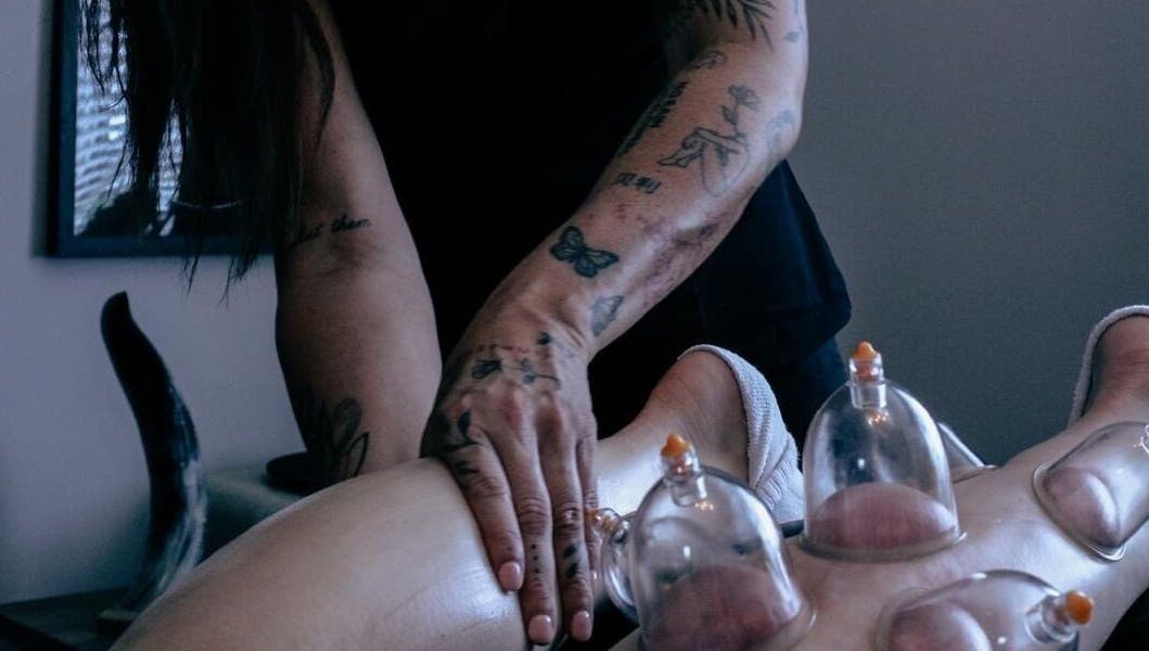 Cupping therapy in progress at Keep Moving Forward, Dumfries, Scotland, GB. Tattooed hand applying cups.