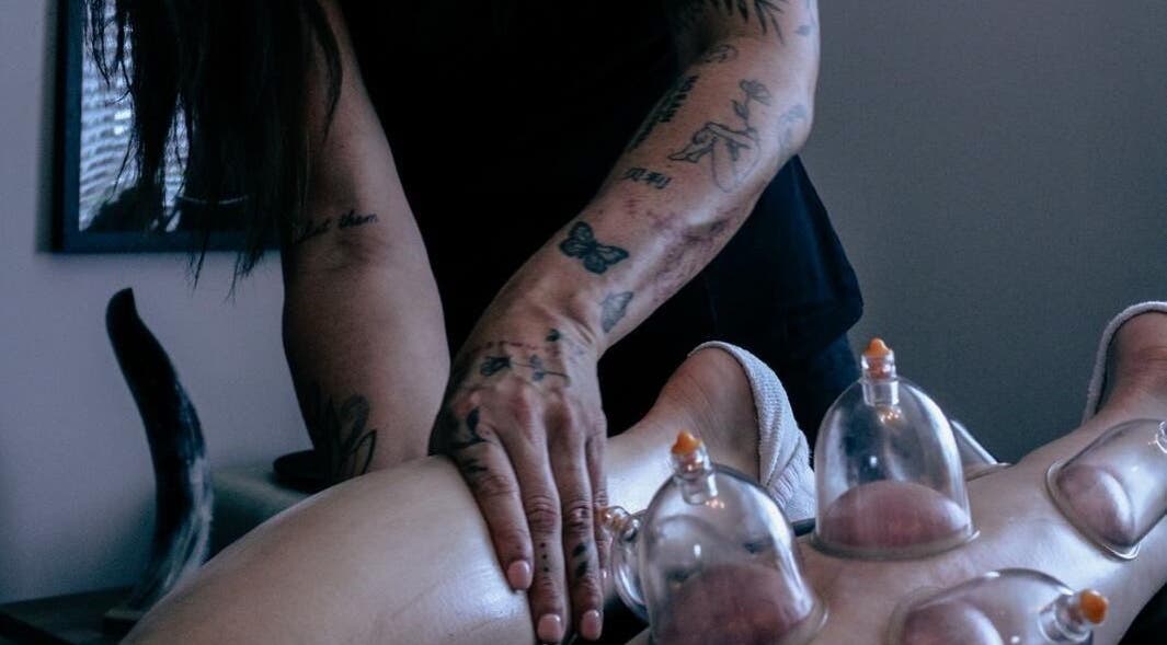 Cupping therapy in progress at Keep Moving Forward, Dumfries, Scotland, GB. Tattooed hand applying cups.