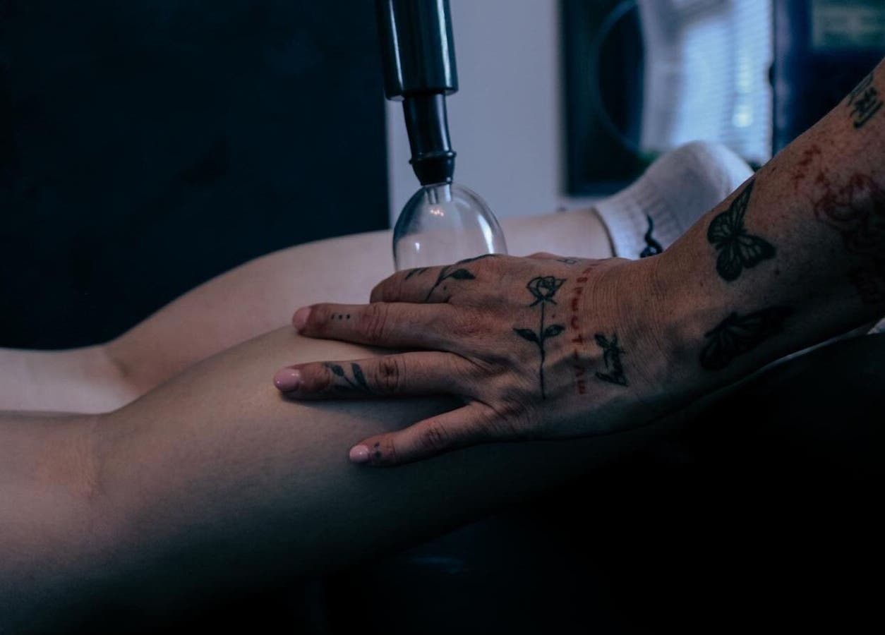 Tattooed hand performing cupping therapy at Keep Moving Forward in Dumfries, Scotland, GB.