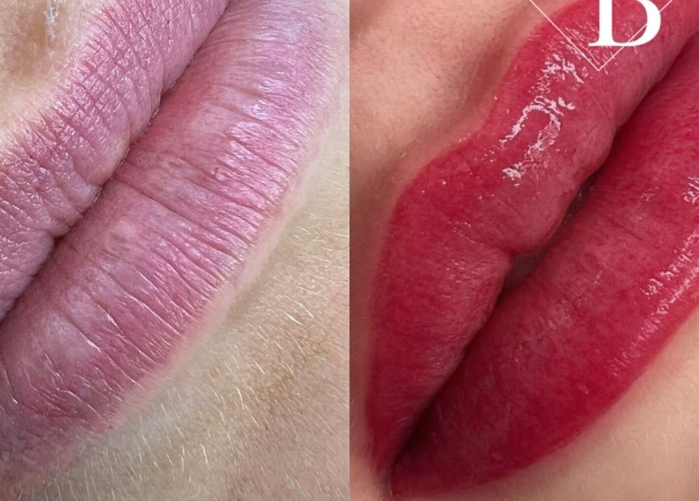 Before and after lip transformation at Durban Designer Brows SA, Umhlanga, Kwazulu-natal, ZA.