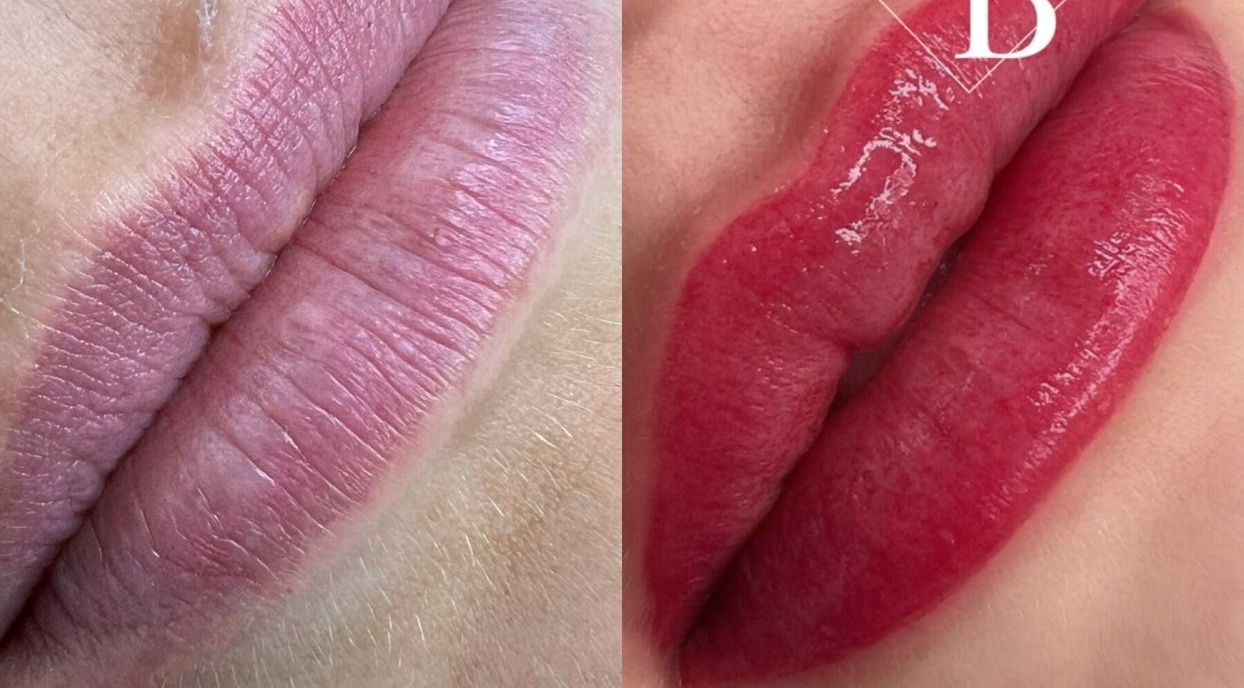 Before and after lip transformation at Durban Designer Brows SA, Umhlanga, Kwazulu-natal, ZA.