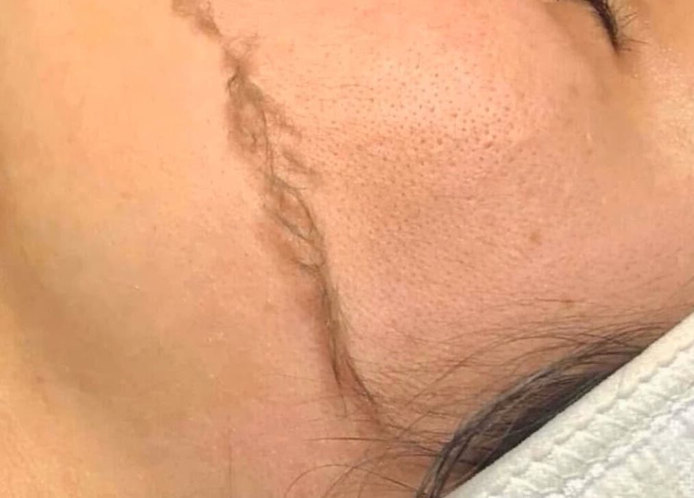 Close-up of a facial treatment at Her.Byron Bay, located in Suffolk Park, New South Wales, AU. Radiant skin results.