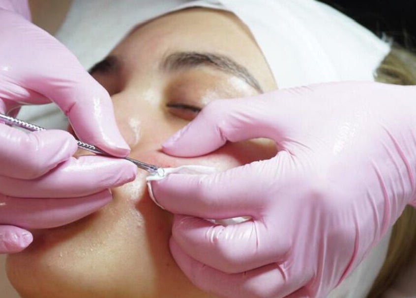 Tratamiento facial en Chula BW, Naucalpan De Juárez, Estado De México, MX. Extracción especializada.