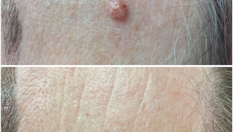 Skin Perfected Ferring image 1