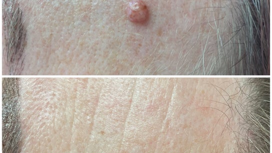 Skin Perfected Ferring