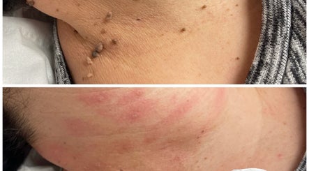 Skin Perfected Ferring image 2