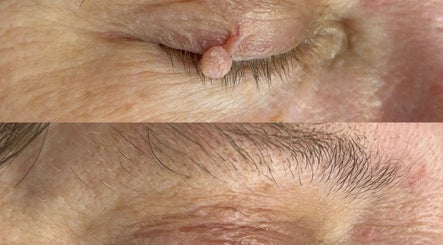 Skin Perfected Ferring image 3