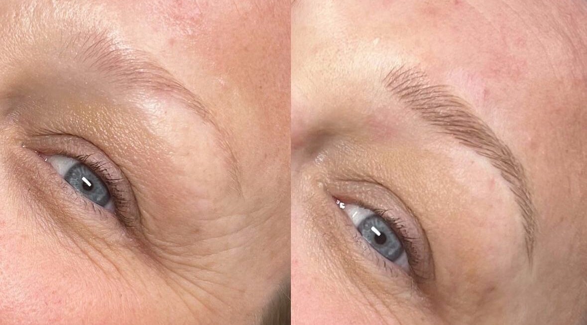 Before and after eyebrow makeover at Amy Lorna Clinic, Waterloo, England, GB showcasing enhanced beauty.