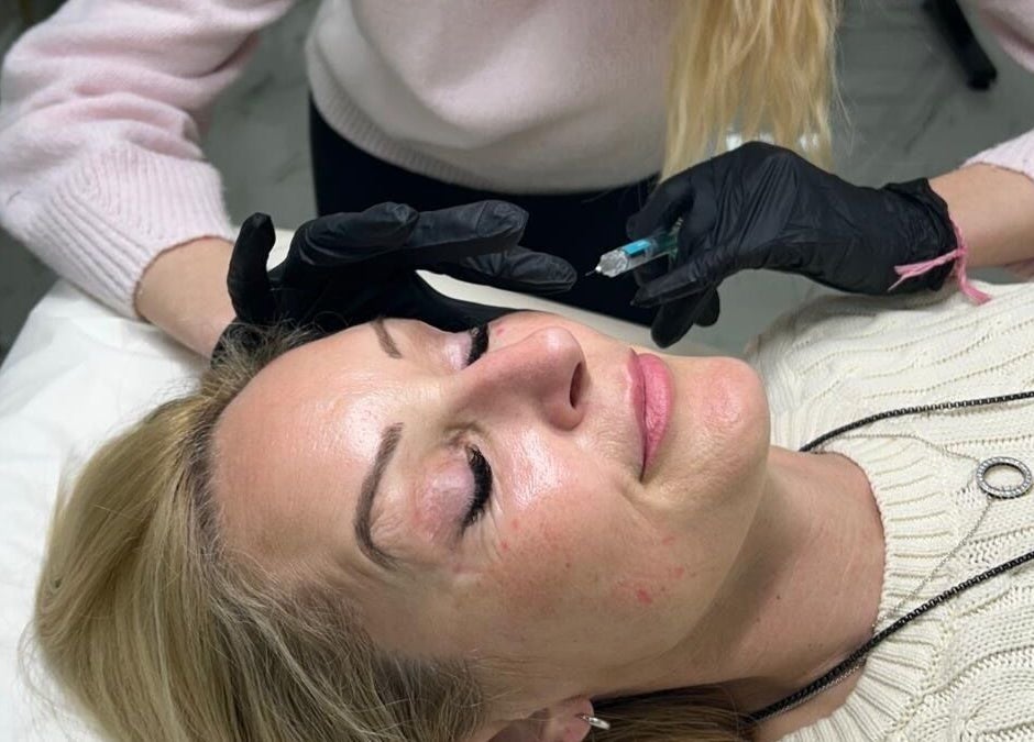 Aesthetic treatment at Isabel Alexandra Aesthetics in Loughborough, England, GB showcasing skilled facial care.