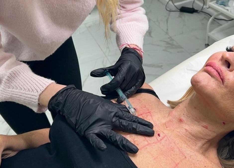 Beauty treatment at Isabel Alexandra Aesthetics in Loughborough, England, GB.