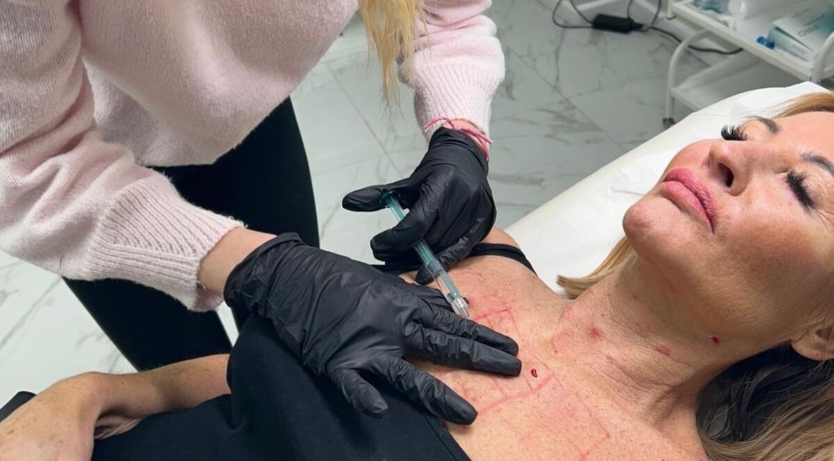 Beauty treatment at Isabel Alexandra Aesthetics in Loughborough, England, GB.