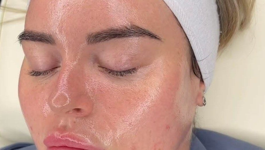 Facial treatment at Synergy Aesthetics Bexley in Bexley, England, GB, showcasing skin rejuvenation.