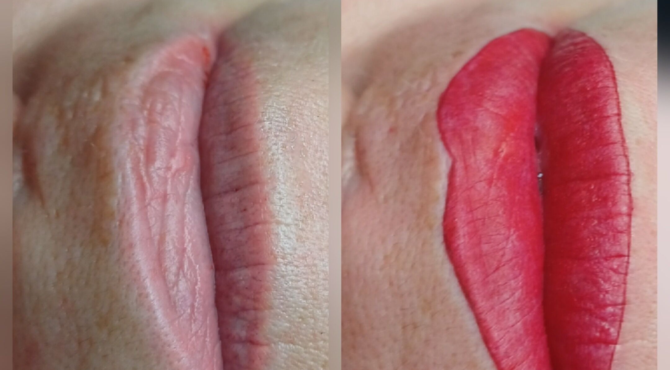 Before and after lip enhancement at Eksklusiv, Hartbeespoort, North West, ZA, showcasing vibrant red results.