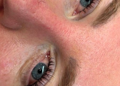 Close-up of eyes showcasing a skin treatment at Layered Collective, Ellesmere Port, England, GB.