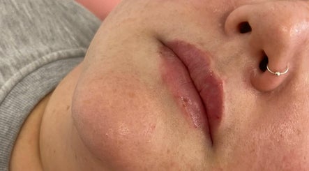 Enhance Aesthetics  image 3