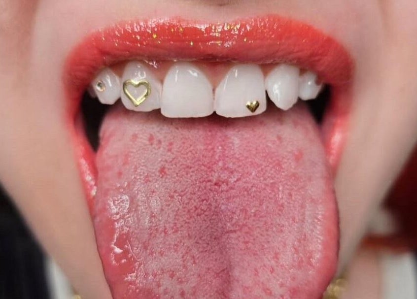 Close-up of teeth with heart gems, KTF Studios, Cardiff, Wales, GB.