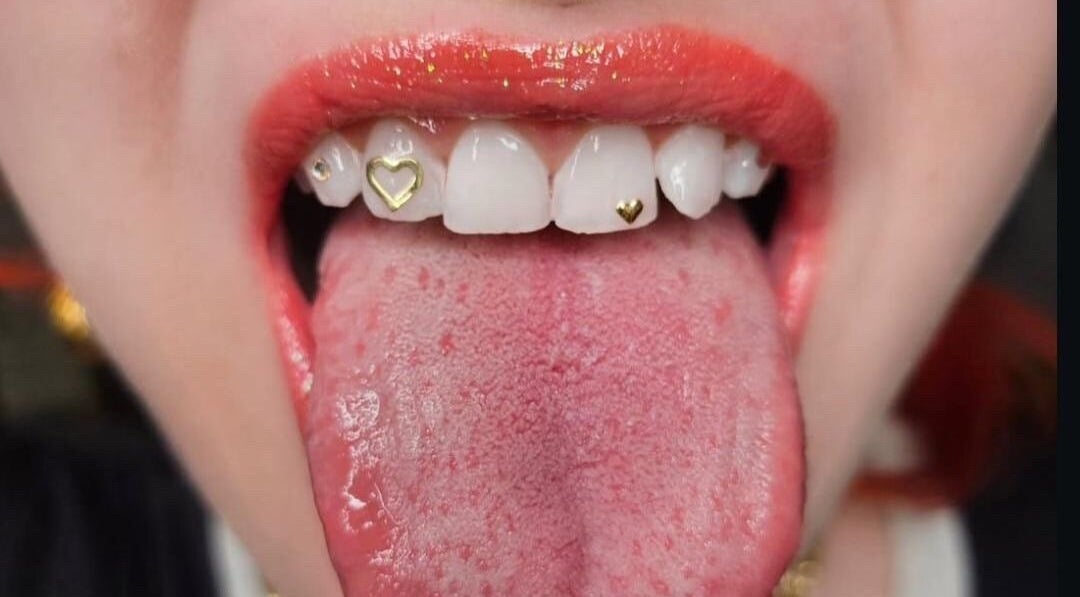 Close-up of teeth with heart gems, KTF Studios, Cardiff, Wales, GB.