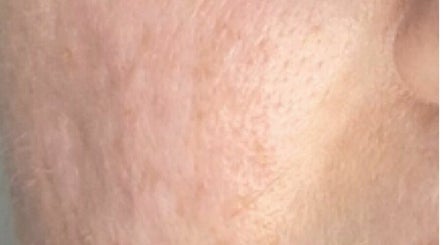 Skin by Janine image 2