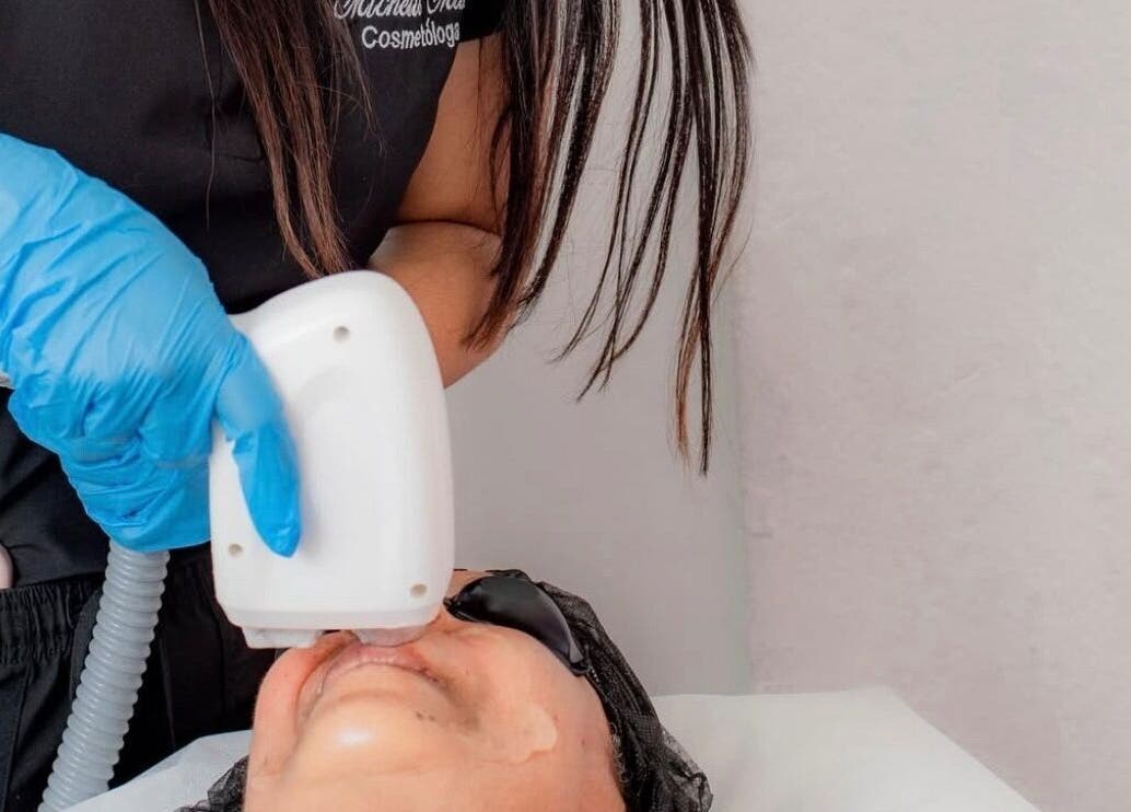 Tratamiento facial en The Beauty Room by Michelle Matos, San Cristóbal, San Cristóbal, DO.