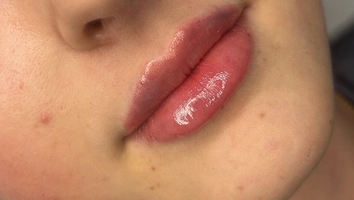 Close-up of glossy lips at Fill My Needs Aesthetics Academy, Hadleigh, England, GB.
