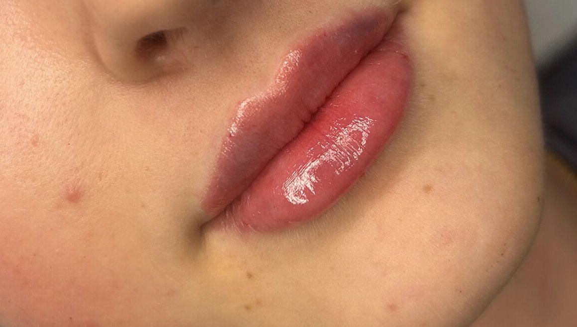 Close-up of glossy lips at Fill My Needs Aesthetics Academy, Hadleigh, England, GB.
