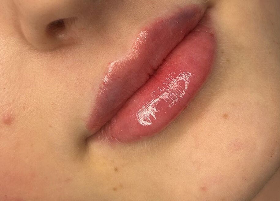 Close-up of glossy lips at Fill My Needs Aesthetics Academy, Hadleigh, England, GB.