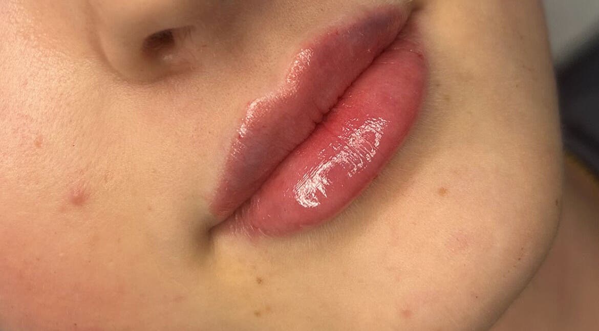 Close-up of glossy lips at Fill My Needs Aesthetics Academy, Hadleigh, England, GB.