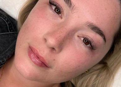 Close-up of rejuvenated skin after facial treatment at Valentina Beauté, Montréal, Québec, CA.