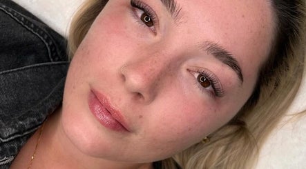 Close-up of rejuvenated skin after facial treatment at Valentina Beauté, Montréal, Québec, CA.