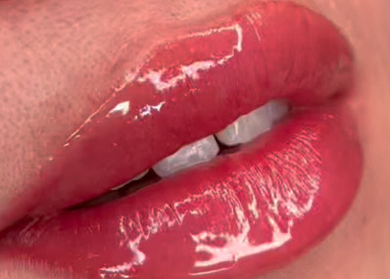 Close-up of glossy red lips at Aio Skin (Friday Glow), Kawakawa, Northland, NZ.