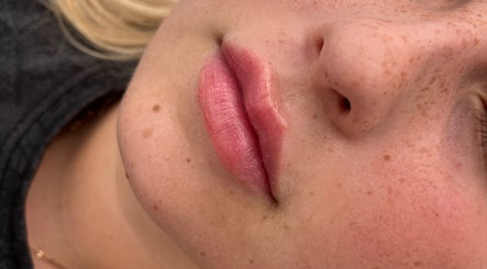 Close-up of smooth, rosy lips showcasing results at Natural Aesthetics, Stoke-on-Trent, England, GB.