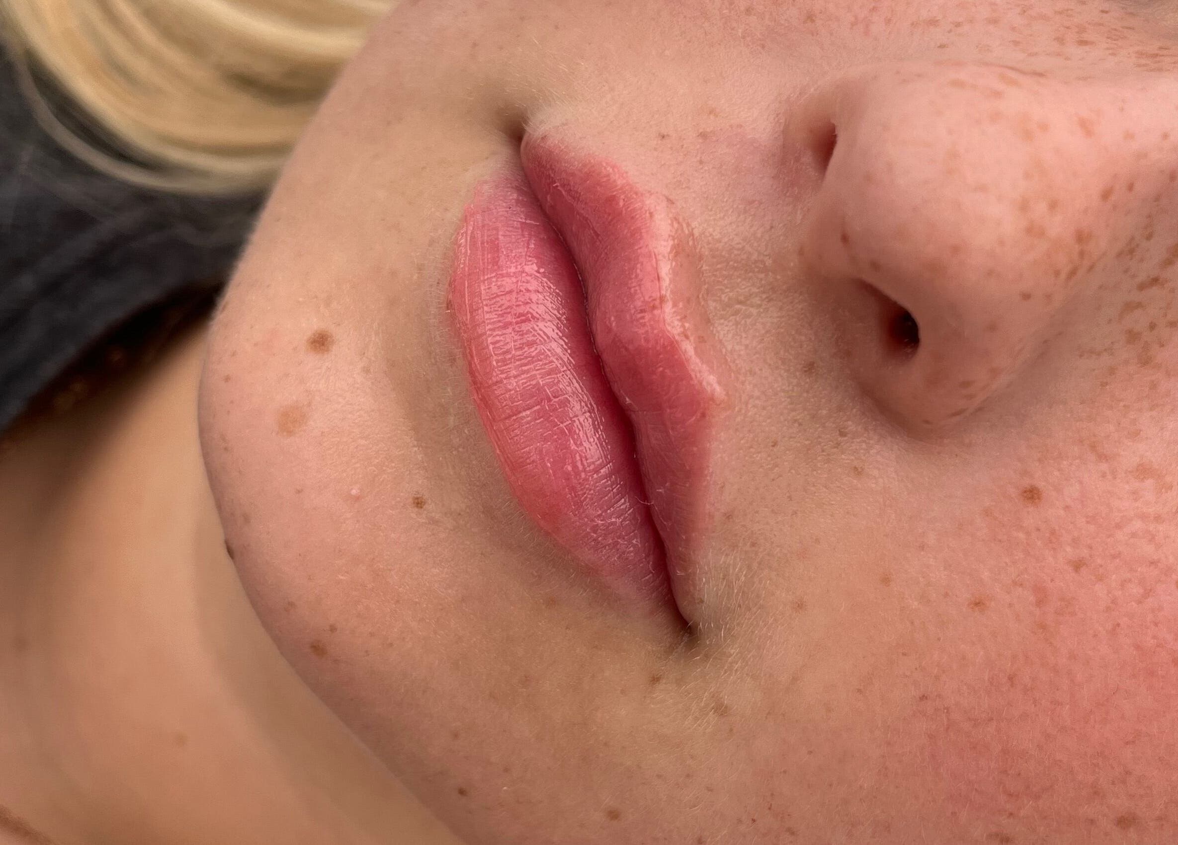 Natural Aesthetics lip care treatment in Stoke-on-Trent, England, GB showcasing smooth, hydrated lips.