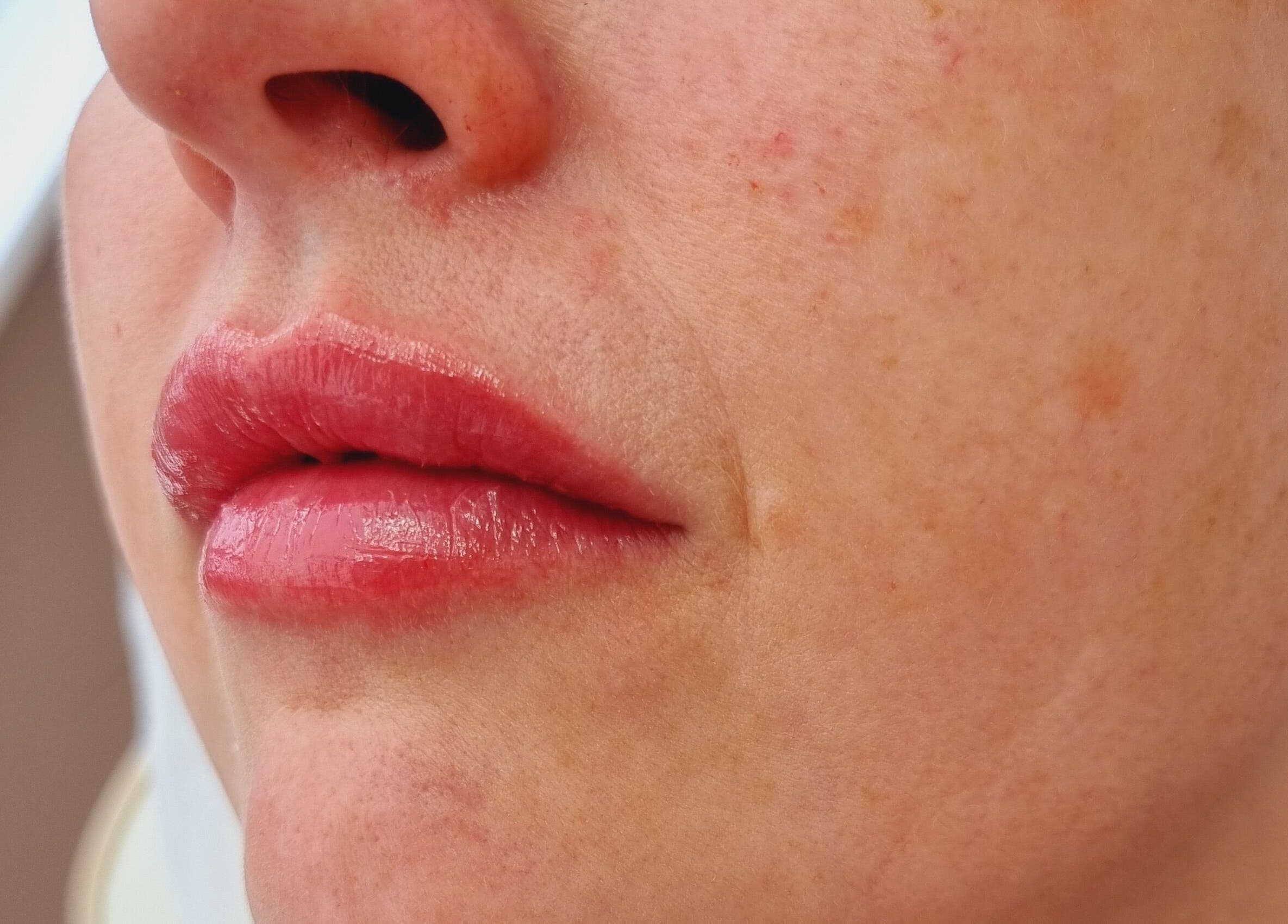 Close-up of smooth lips and skin at Natural Aesthetics, Stoke-on-Trent, England, GB.